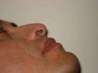 Embellece tu imagen con los correctores nasales unisex - ordenalos al (549)2215046096 - nariz bella y respingada