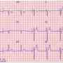 electrocardiogramas a domicilio holter 24hs 1530774400