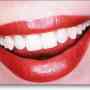 prótesis dentales acrílicas,flexibles,fijas,consultorio dental, odontologico,dentista
