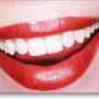 ¿Cómo mantener los dientes blancos? Limpieza y visitas frecuentes al odontólogo, la clave