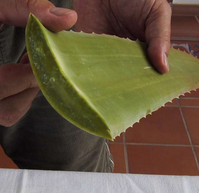 Como Curar Las Quemaduras De Sol Con Aloe Vera En Buenos Aires Libros